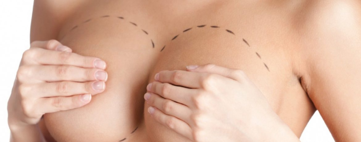 Mamoplastia: conheça os tipos de plásticas que modelam as mamas