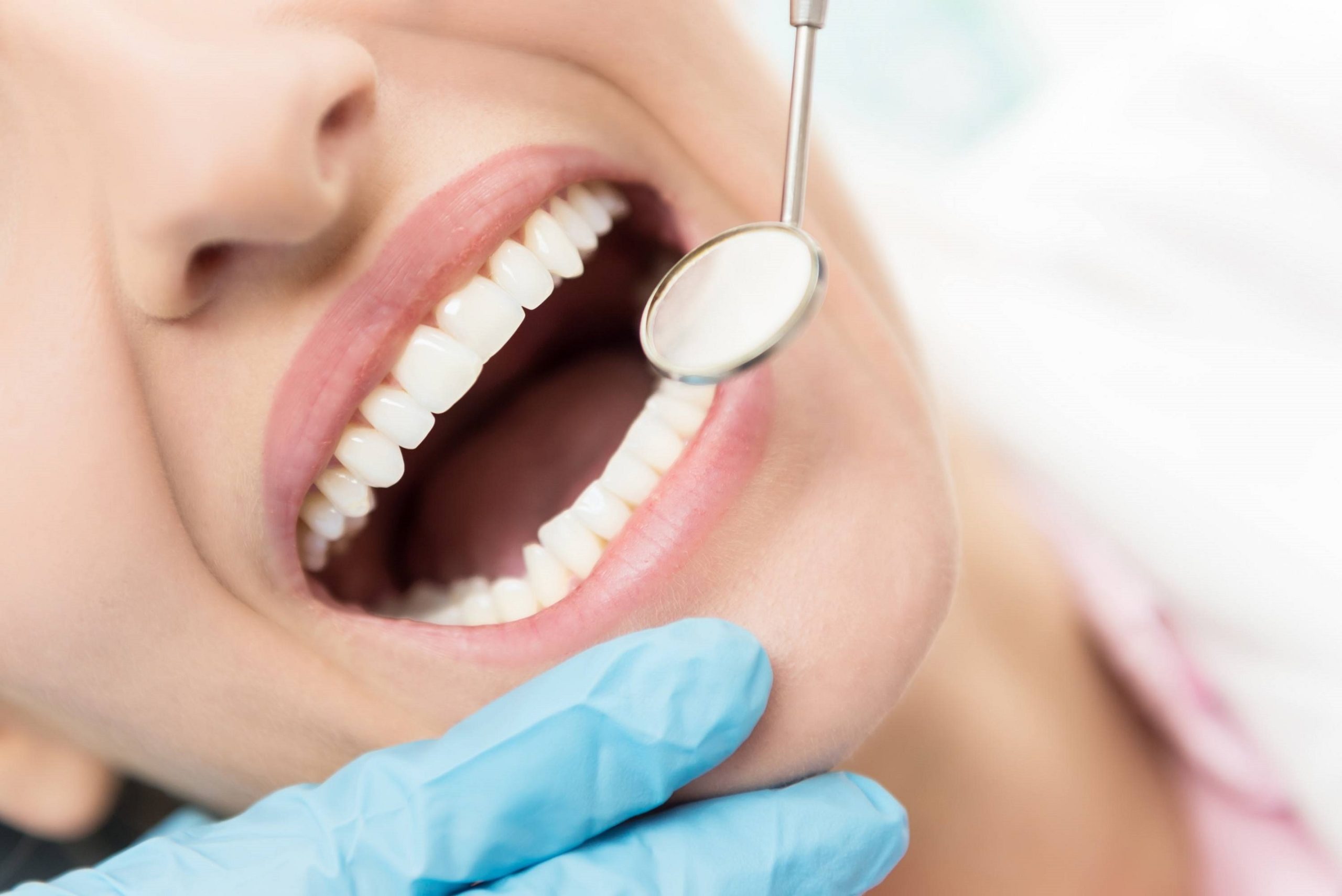 Dentes Saudáveis, Vida Feliz: Como Evitar e Tratar a Cárie Dentária de Forma Definitiva
